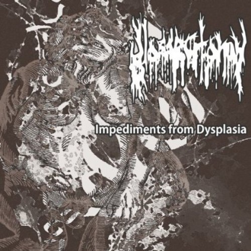 Impediments from Dysplasia