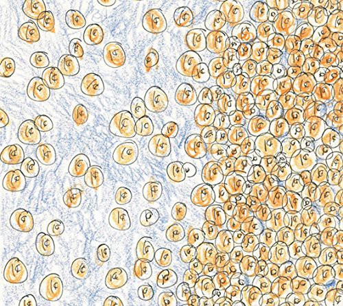 Greenberger, David & Dozens : Near the Edge of the Penny Jar Spill