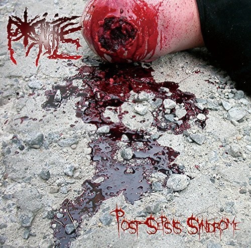 Post-sepsis Syndrome