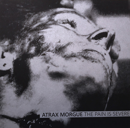 Pain Is Severe