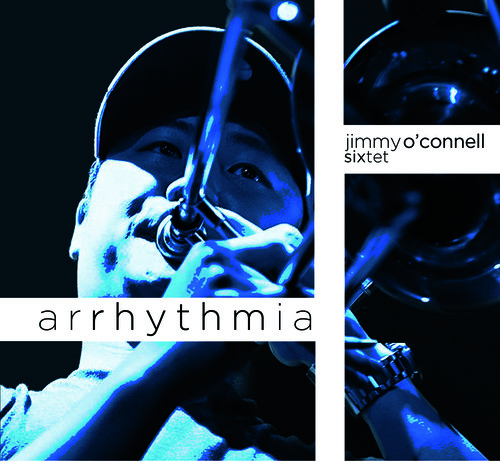 Arrhythmia