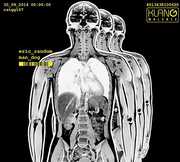 Man Dog , Eric Random