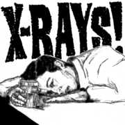 Jameson Shot , The X-Rays