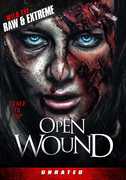 Open Wound 